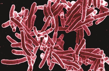 mycobacterium-tuberculosis-micrograph-15